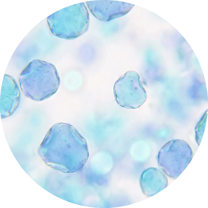 from donor<br> to sachet, every step is screened